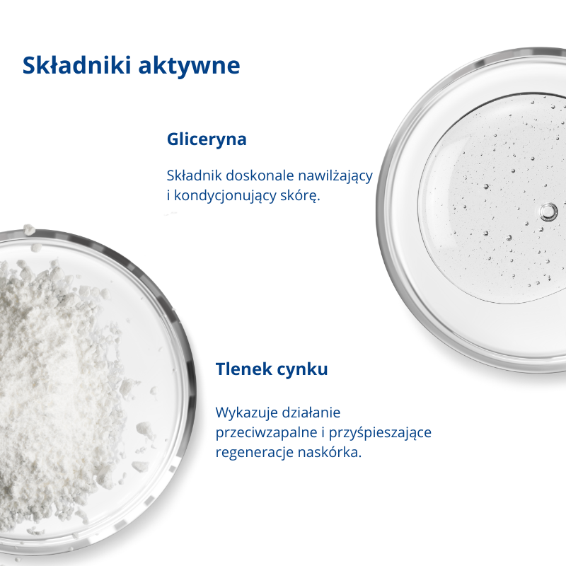 Krem na odparzenia "Zdrowa Pupka" - Skarb Matki