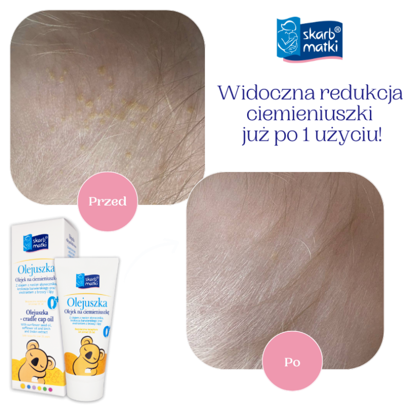 Zestaw Olejuszka + Szampon dla niemowląt i dzieci - Skarb Matki